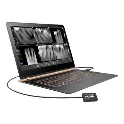 Комплект Xelium Ultra PD и Fona StarX PRO - низкочастотный портативный дентальный рентген с визиографом Фото товара Комплект Xelium Ultra PD и Fona StarX PRO - низкочастотный портативный дентальный рентген с визиографом