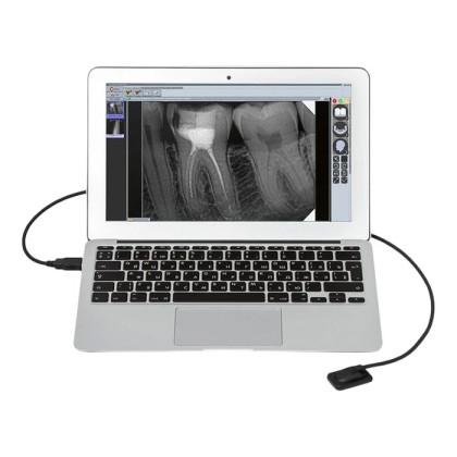 Комплект рентген Evolution X3000 и визиограф Mercury DIGISENS Фото товара Комплект рентген Evolution X3000 и визиограф Mercury DIGISENS