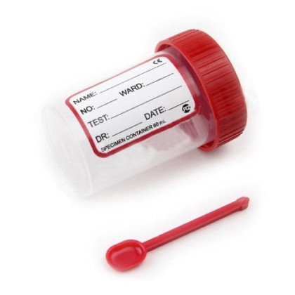 Контейнер для сбора 60 мл с встроенной лопаткой НЕСТЕРИЛЬНЫЙ Фото товара Контейнер для сбора 60 мл с встроенной лопаткой НЕСТЕРИЛЬНЫЙ