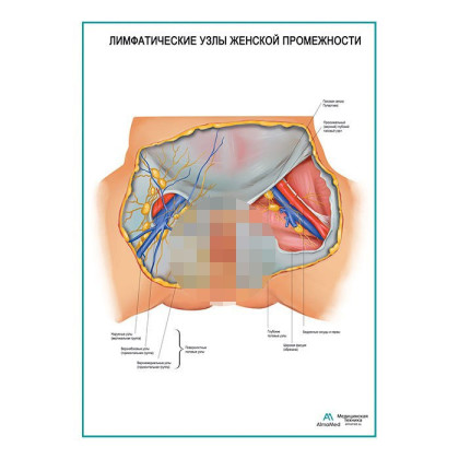 Фото товара Лимфатические узлы женской промежности плакат глянцевый А1+/А2+