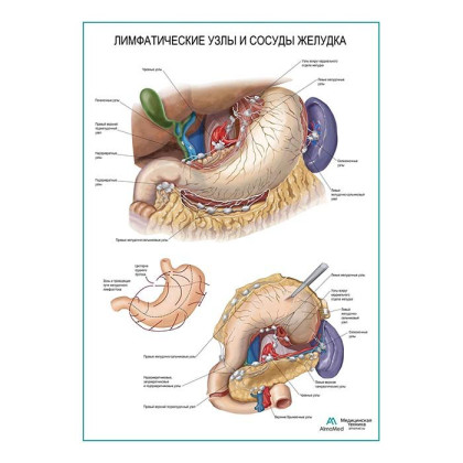 Лимфатические узлы и сосуды желудка плакат глянцевый А1+/А2+ Фото товара Лимфатические узлы и сосуды желудка плакат глянцевый А1+/А2+