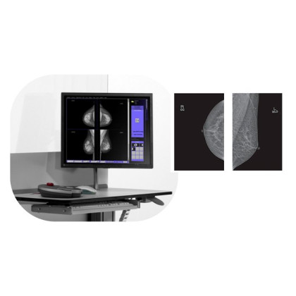 Фото товара Маммограф PINKVIEW-AT DR Plus Expert Bemems