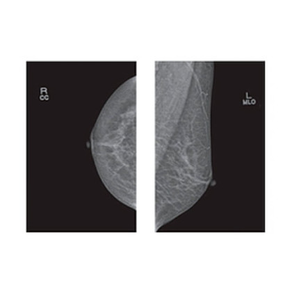 Фото товара Маммограф Pinkview-RT аналоговый Bemems