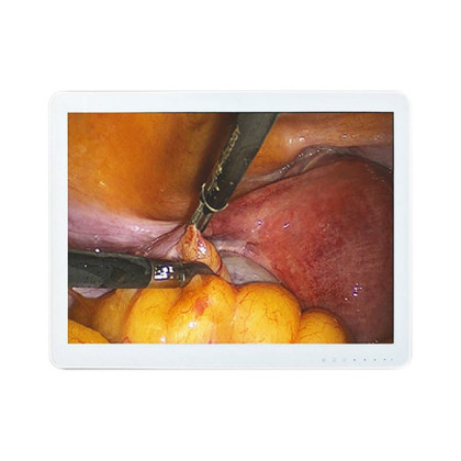 Фото товара Монитор для эндоскопа 19 дюймов Huger