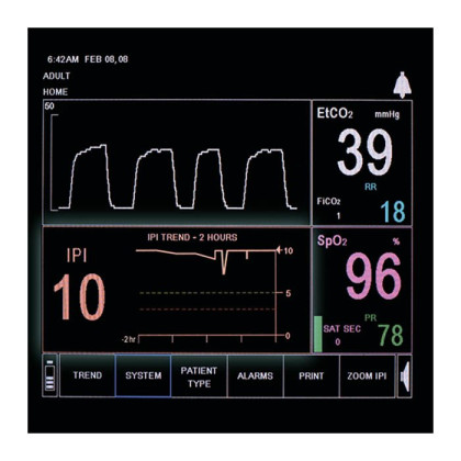 Фото товара Монитор дыхательных функций (капнограф-пульсоксиметр) Capnostream