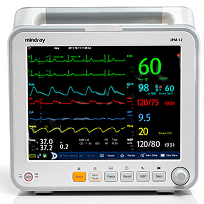 Монитор пациента Mindray iPM 12 Фото товара Монитор пациента Mindray iPM 12