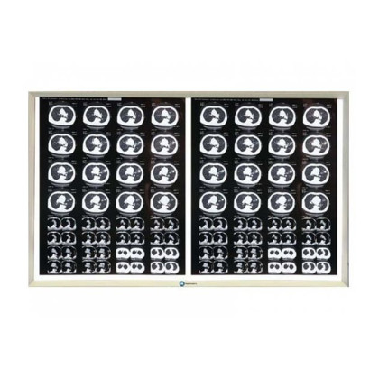 Негатоскоп LED на 2 снимка Фото товара Негатоскоп LED на 2 снимка
