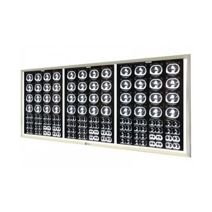Негатоскоп LED на 3 снимка Фото товара Негатоскоп LED на 3 снимка