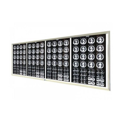 Негатоскоп LED на 4 снимка Фото товара Негатоскоп LED на 4 снимка