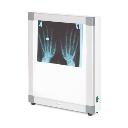 Фото товара Негатоскоп общего назначения 1-кадровый АРМЕД