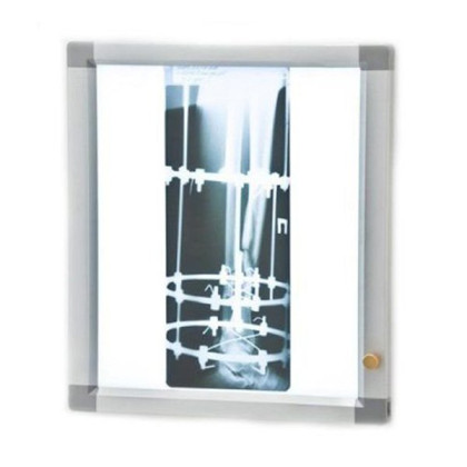 Негатоскоп общего назначения 1-кадровый флуоресцентный Армед Фото товара Негатоскоп общего назначения 1-кадровый флуоресцентный Армед