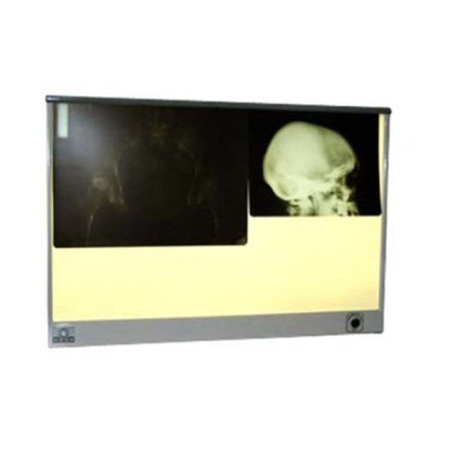 Негатоскоп общего назначения "ПОНИ" НР2-02 Фото товара Негатоскоп общего назначения "ПОНИ" НР2-02