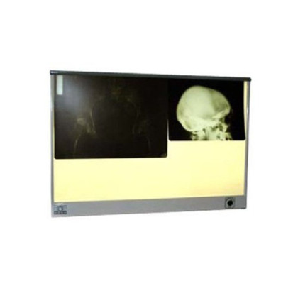 Негатоскоп общего назначения "ПОНИ" НР3-02 Фото товара Негатоскоп общего назначения "ПОНИ" НР3-02