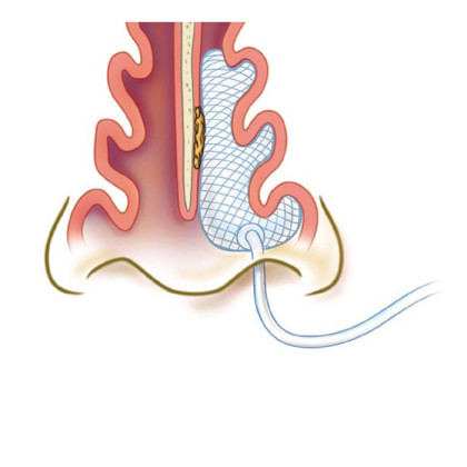 Носовой тампон Goodman 5.5см Фото товара Носовой тампон Goodman 5.5см
