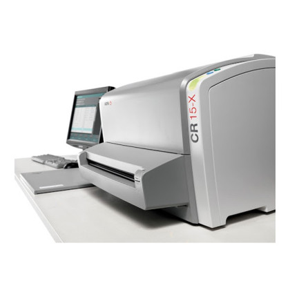 Фото товара Оцифровщик (дигитайзер) AGFA CR 15-X