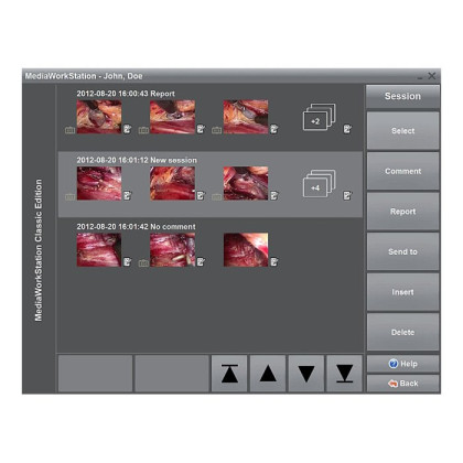 ПО для эндовидеокамер Dantschke MediaWorkStation 2.9 Basic Фото товара ПО для эндовидеокамер Dantschke MediaWorkStation 2.9 Basic