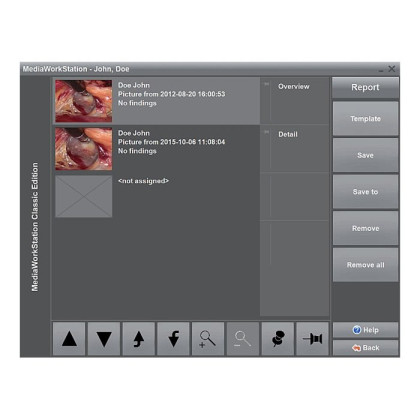 ПО для эндовидеокамер Dantschke MediaWorkStation 2.9 Basic Фото товара ПО для эндовидеокамер Dantschke MediaWorkStation 2.9 Basic