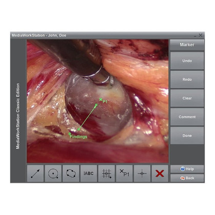 ПО для эндовидеокамер Dantschke MediaWorkStation 2.9 Basic Фото товара ПО для эндовидеокамер Dantschke MediaWorkStation 2.9 Basic