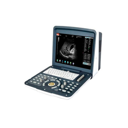 Фото товара Переносной УЗИ сканер AcuVista RS880d