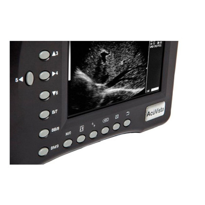 Портативный УЗИ сканер AcuVista RS880b Фото товара Портативный УЗИ сканер AcuVista RS880b