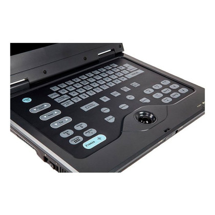 Портативный УЗИ сканер AcuVista RS880c Фото товара Портативный УЗИ сканер AcuVista RS880c