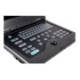 Портативный УЗИ сканер AcuVista RS880c Фото товара Портативный УЗИ сканер AcuVista RS880c