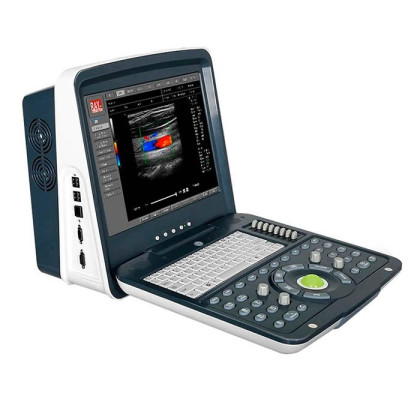 Портативный УЗИ сканер с цветным допплером AcuVista RS880i Фото товара Портативный УЗИ сканер с цветным допплером AcuVista RS880i