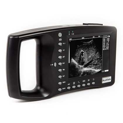 Фото товара Портативный УЗИ-сканер AcuVista RS880b