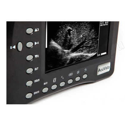 Фото товара Портативный УЗИ-сканер AcuVista RS880b