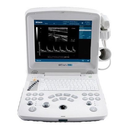 Портативный УЗИ-сканер EDAN DUS 60 Vet Фото товара Портативный УЗИ-сканер EDAN DUS 60 Vet
