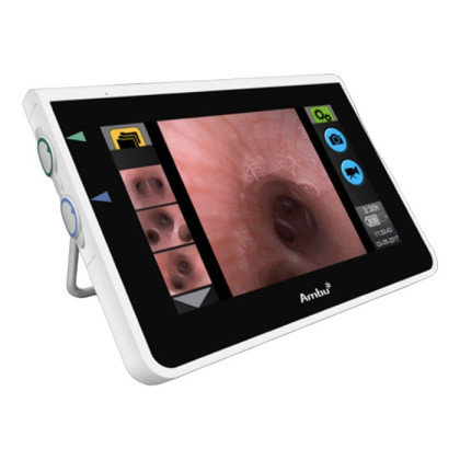 Портативный монитор для гибкого бронхоскопа AMBU aView Фото товара Портативный монитор для гибкого бронхоскопа AMBU aView