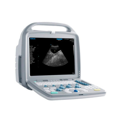 Портативный ультразвуковой сканер CTS 7700 SIUI, Китай Фото товара Портативный ультразвуковой сканер CTS 7700 SIUI, Китай