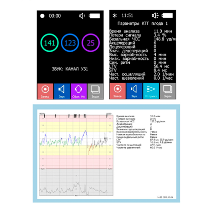 Фото товара Портативный фетальный монитор Илифия