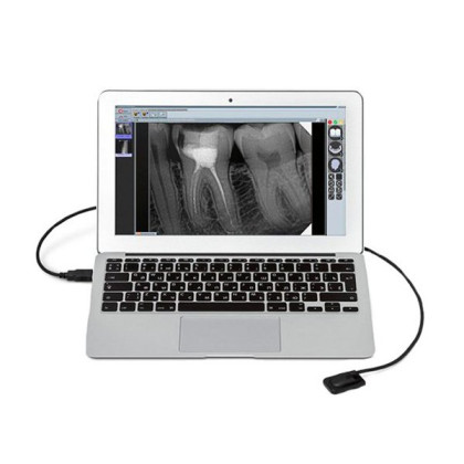 Радиовизиограф Mercury Digisens Фото товара Радиовизиограф Mercury Digisens