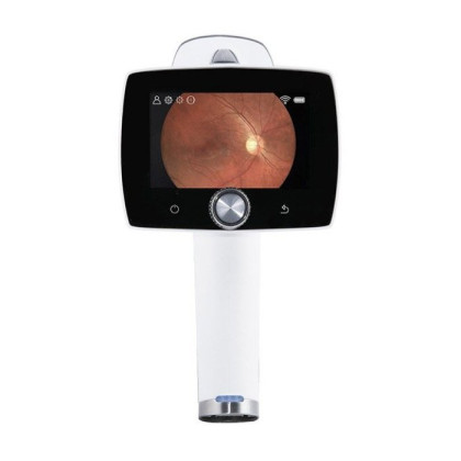 Ручная цифровая ретинальная камера AURORA, Optomed Фото товара Ручная цифровая ретинальная камера AURORA, Optomed