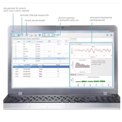 Фото товара Система для ОАЭ, КСВП, импедансометрии и аудиологического скрининга "Аудио-Смарт"