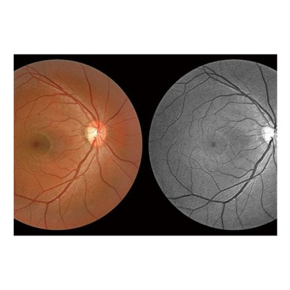 Фото товара Томограф спектральный оптический когерентный, вариант исполнения: НОСТ-1, HUVITZ