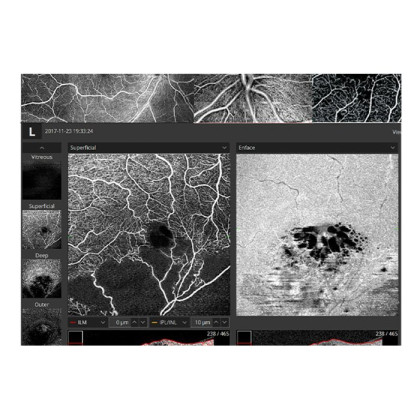 Фото товара Томограф спектральный оптический когерентный, вариант исполнения: НОСТ-1, HUVITZ