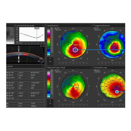 Фото товара Томограф спектральный оптический когерентный, вариант исполнения: НОСТ-1, HUVITZ