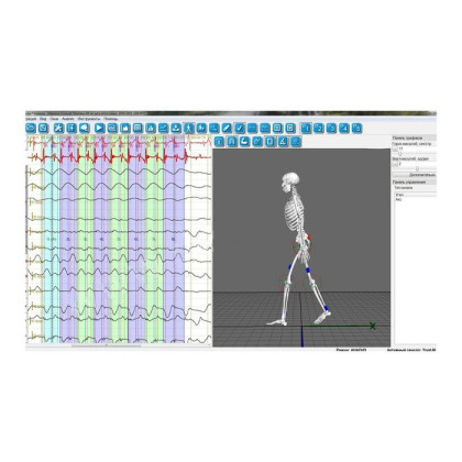 Фото товара Тренажер ходьбы Траст-М