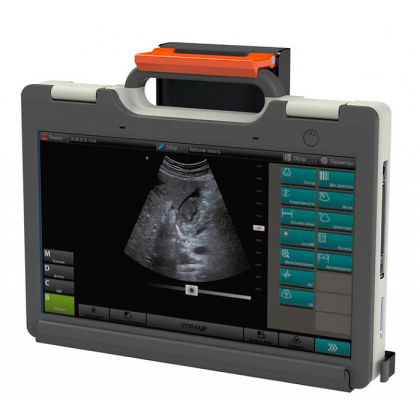 Фото товара УЗИ сканер SmartScan 15