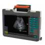 Фото товара УЗИ сканер SmartScan 15
