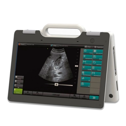 Фото товара УЗИ сканер SmartScan 15