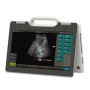 Фото товара УЗИ сканер SmartScan 15