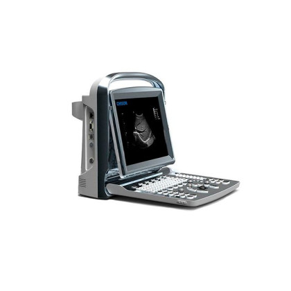 Фото товара УЗИ сканер SonoTouch 10 Chison