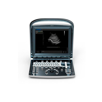 Фото товара УЗИ сканер SonoTouch 10 Chison