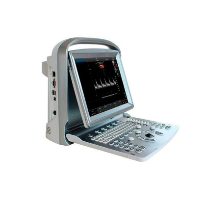 Фото товара УЗИ сканер SonoTouch 50 Chison