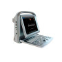 Фото товара УЗИ сканер SonoTouch 50 Chison