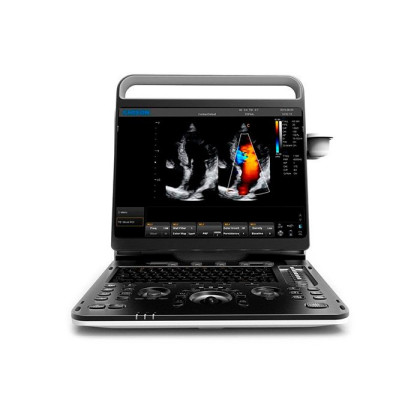 Фото товара УЗИ сканер SonoTouch 60 Chison