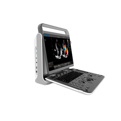 Фото товара УЗИ сканер SonoTouch 60 Chison